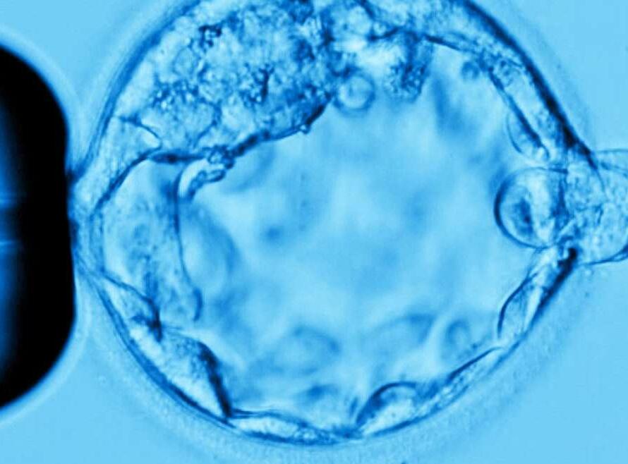 PGT Diagnosi genetica preimpianto