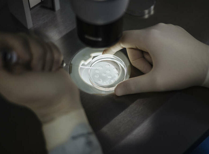 fecondazione in vitro a Napoli