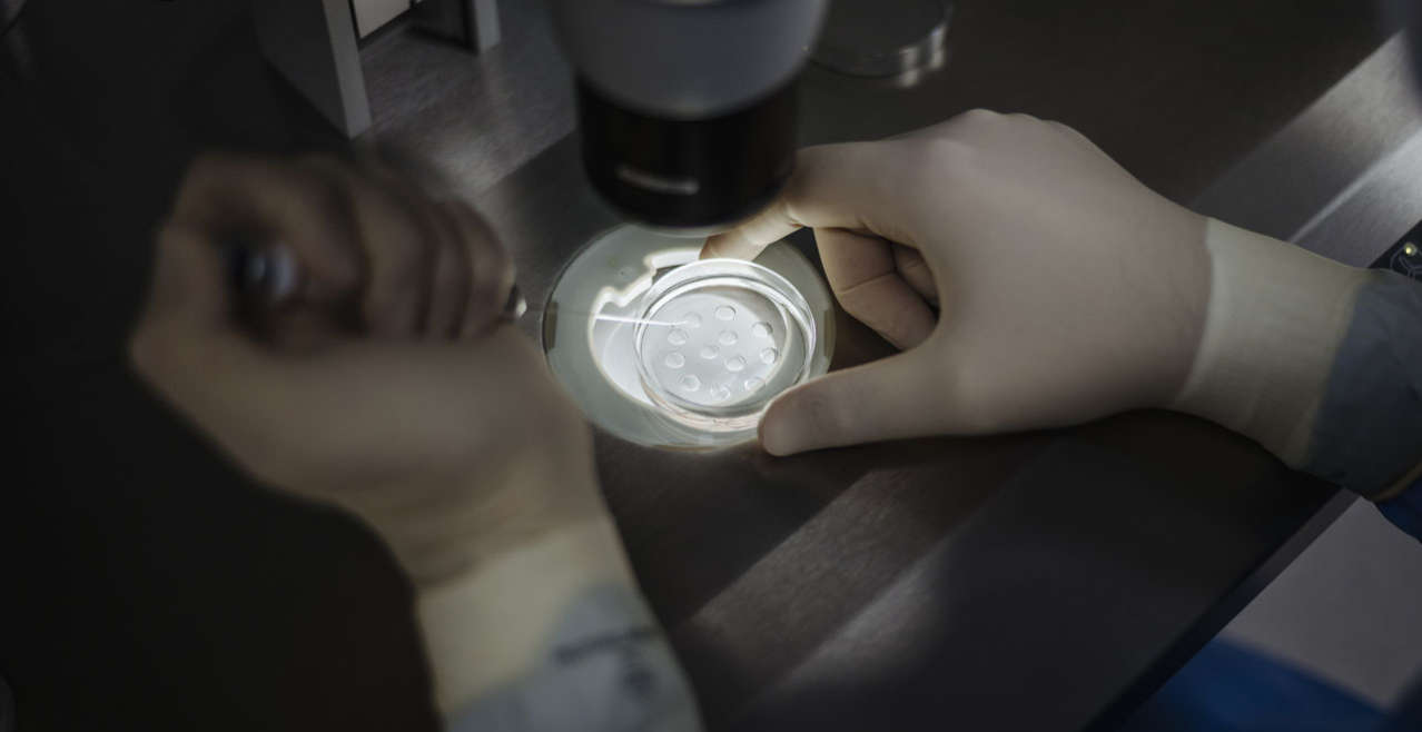 Fecondazione in Vitro