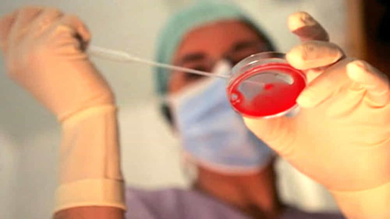Preservazione della Fertilità