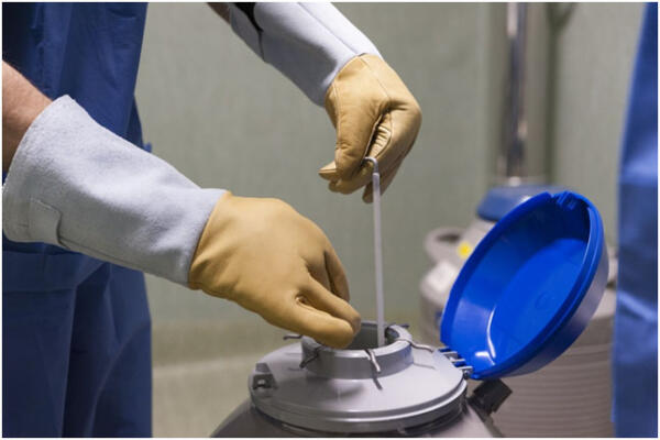 Congelamento degli ovuli a Napoli