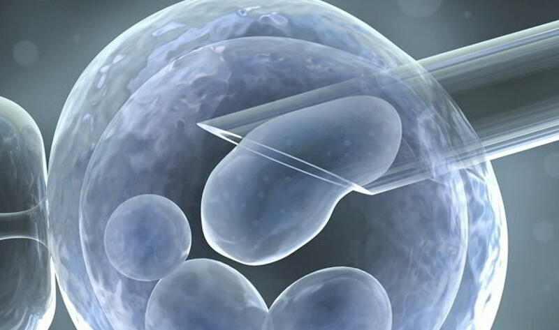 Endometriosi e qualità ovocitaria a Napoli