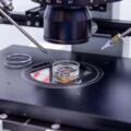 Endometriosi e ICSI a Napoli