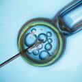 Endometriosi e transfer embrionale a Napoli