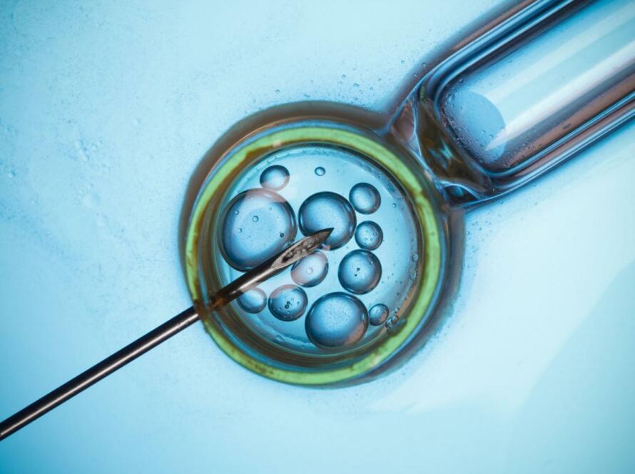 Endometriosi e transfer embrionale a Napoli